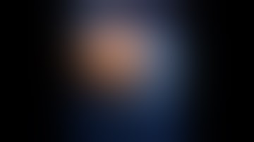 Robotic Gastric wedge resection