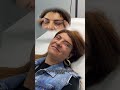 Blefaroplastie superioară și Foxy Eyes