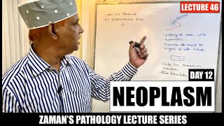 General Pathology: Lecture 46 | Neoplasm - Day 12
