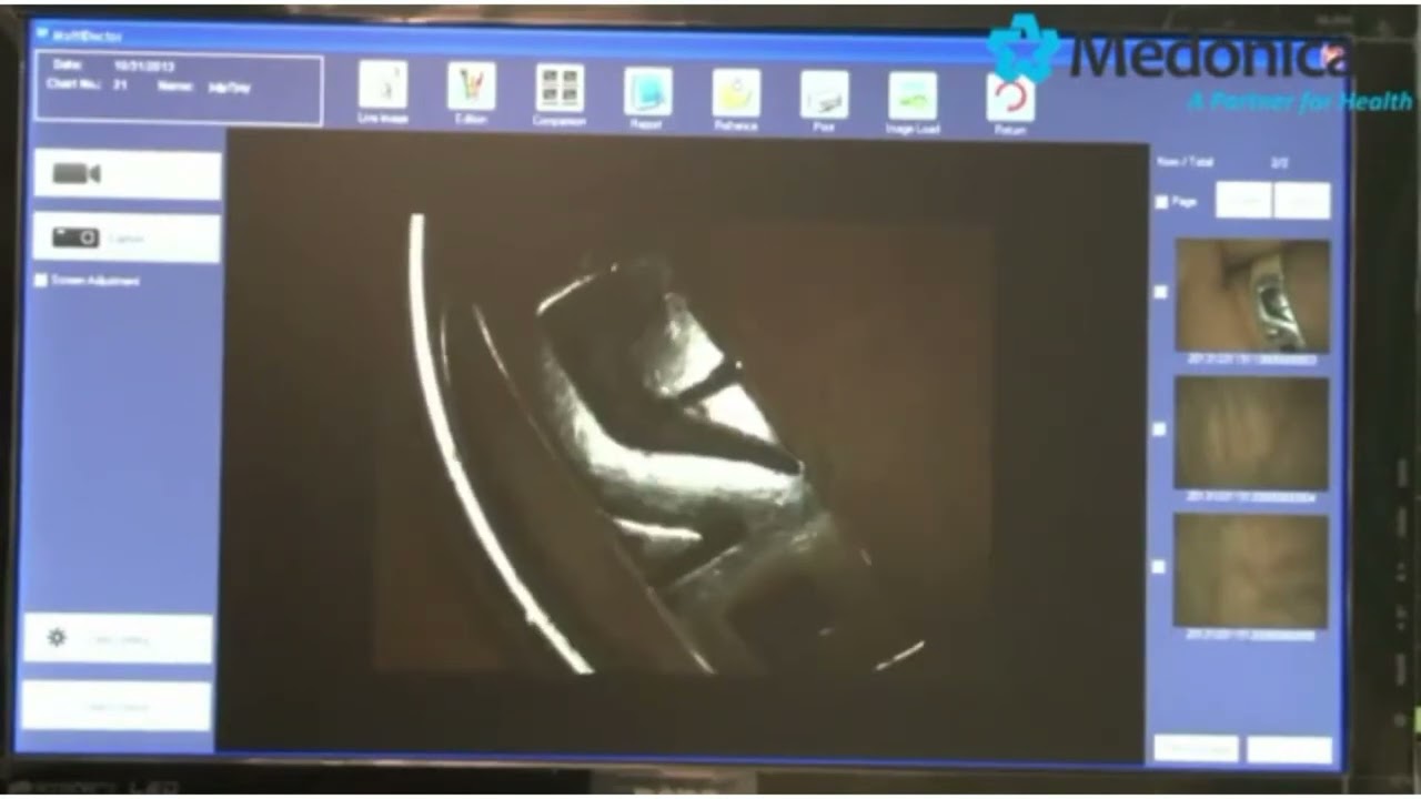 Medonica Dr.Camscope DCS-102 и DCS-104t