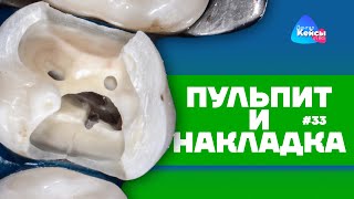 Пульпит и накладка | Дентал Кейсы от BG #33