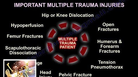 Managing Ortho Injuries Multiple Trauma Patients - Everything You Need To Know - Dr. Nabil Ebraheim