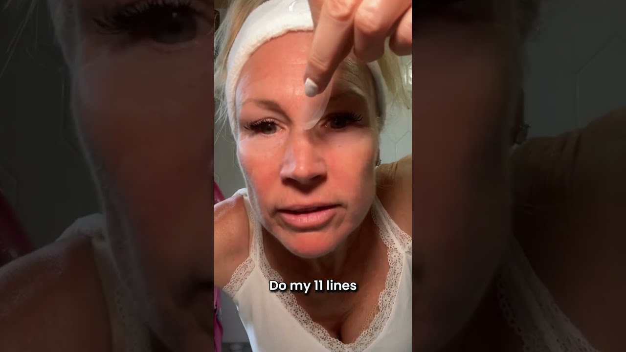 Forget botox & start using these microneedling patches for those fine lines & wrinkles! 🤯 