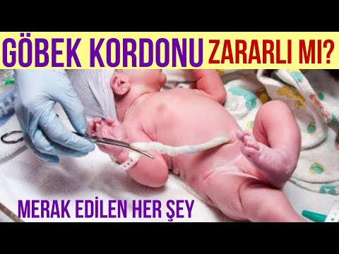 Video: Göbek Kordonunu Sevmeyi Veya Kesmeyi Nasıl Bıraktım?