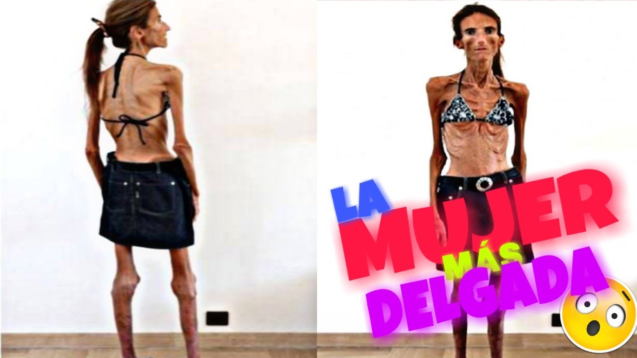 La HISTORIA de la MUJER más DELGADA del MUNDO - YouTube