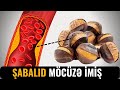 Şabalıd Damarları Necə Təmizləyir? - MÖCÜZƏ TÜRKƏÇARƏ