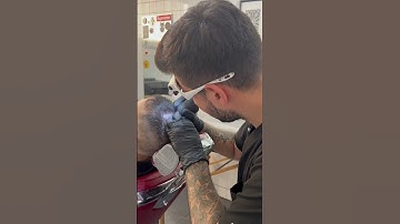 Excellent example of density work. #scalpmicropigmentation #hairlosstreatment #hairtattoo #shorts