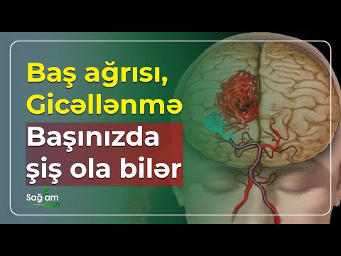 Video: Sklerit diaqnozu necə qoyulur?