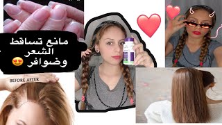 فيتامينات لتقويه الأظافر ومنع تساقط الشعر (فيديو مهم)