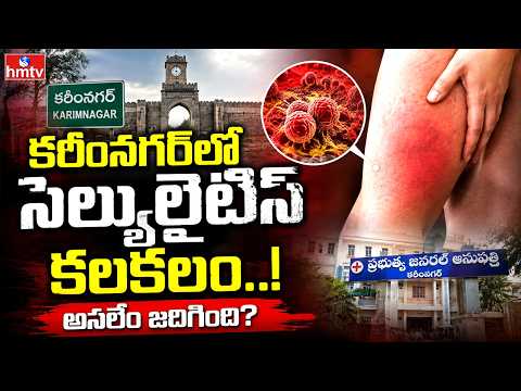 కరీంనగర్‌లో సెల్యులైటిస్ కలకలం.. అసలేం జరిగింది? | Cellulitis Cases Rising in Karimnagar | hmtv - HMTVNEWS