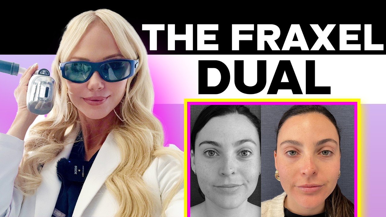 Why Fraxel Laser is my GO-TO Treatment for BEAUTIFUL Skin