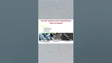 Очищение кишечника, квашеная капуста