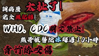 青竹絲咬傷到底能不能冰敷？WHO、CDC明文禁止！熊哥卻被冰超過12小時？調病歷→完全沒紀錄！太扯了！