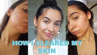 HOW I FINALLY CLEARED MY SKIN! (fast + naturally)