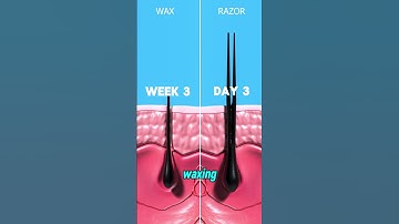Shaving vs. Waxing: Discover the key differences and find out which hair removal method is best