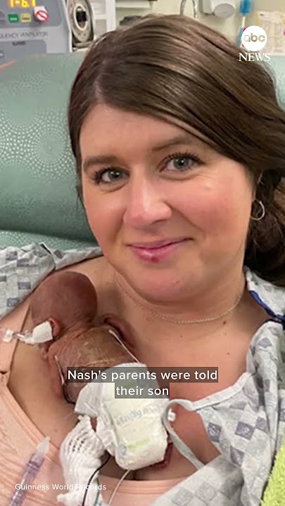 ‘World’s most premature baby’ celebrates 1st birthday