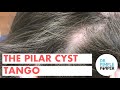 The Pilar Cyst Tango