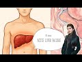 All about Acute Liver Failure : Causes, Symptoms, Diagnosis