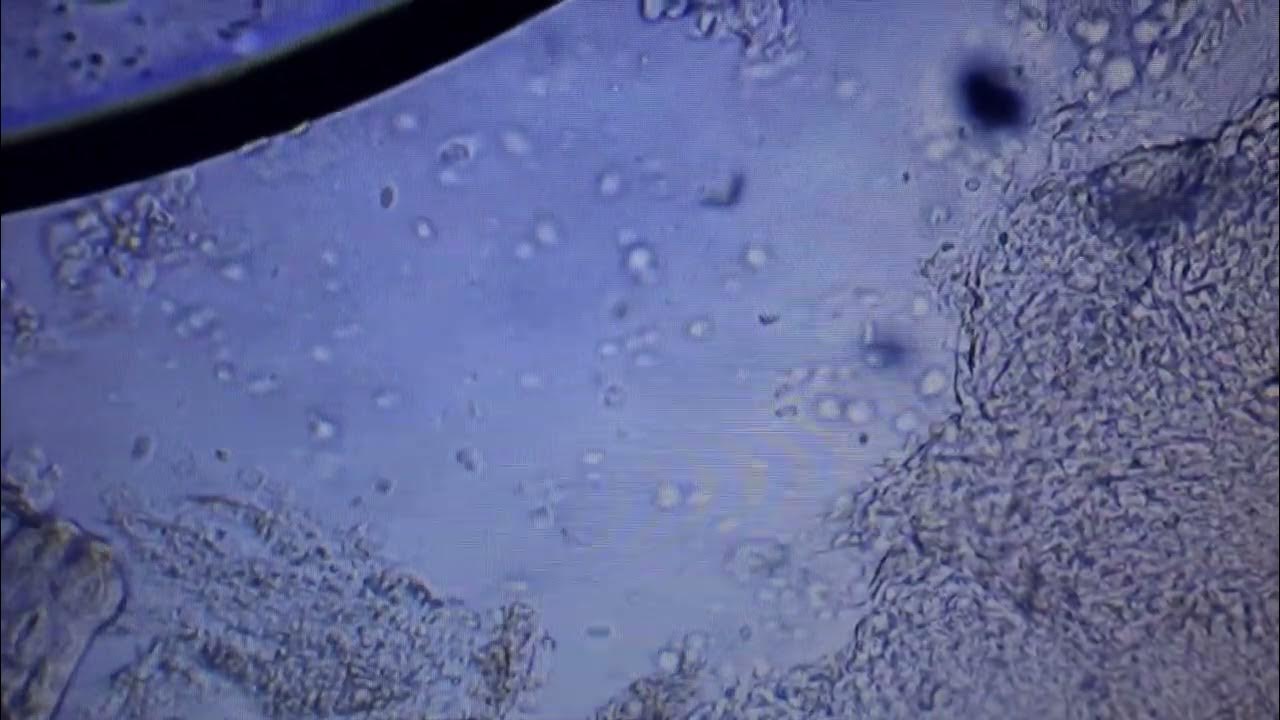 Elite Koi Fish Health Skin Fluke & Costia Main focus on the very