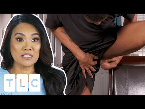Dr. Lee Removes Lump That Looks Like Third Testicle! I Dr. Pimple Popper: Pop Ups
