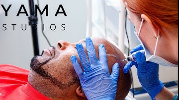 When Can I Wash My Hair After Scalp Micropigmentation? SMP Explained