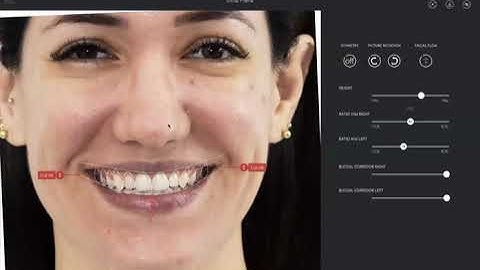 AI 3D Smile Design with SmileFy 4.0 | Webinar
