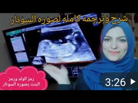 رمز الجنين الذكر ورمز الجنين الانثي بصورة السونار Youtube