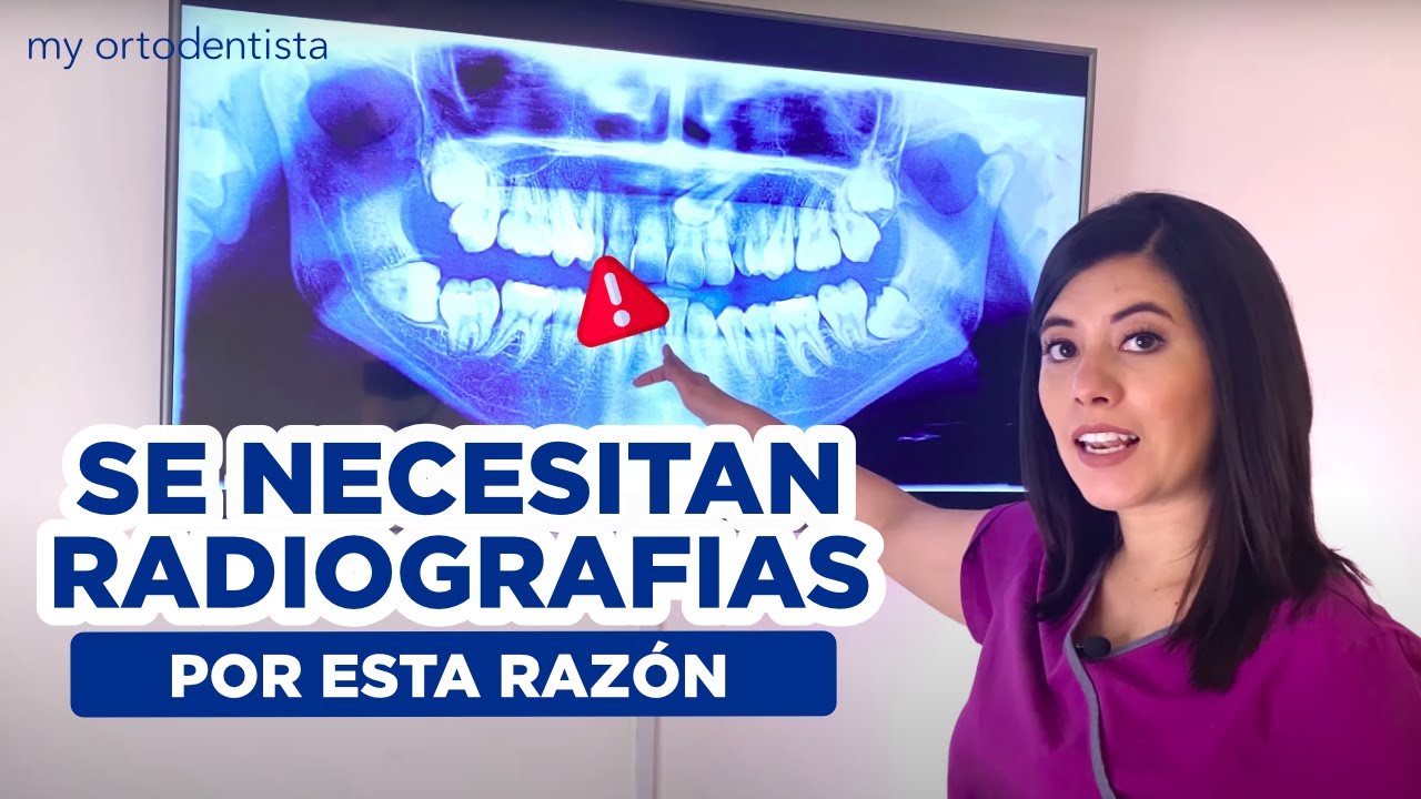 QUE PASA SI NO TE TOMARON RADIOGRAFIAS ANTES DE PONERTE BRACKETS/ RIESGOS QUE CORREN TUS DIENTES