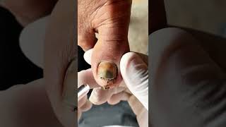 Les ongles de ma mère après avoir fait le potager