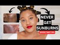 How to treat and get rid of sunburn  hyperpigmentation permanently for a bright an even skintone