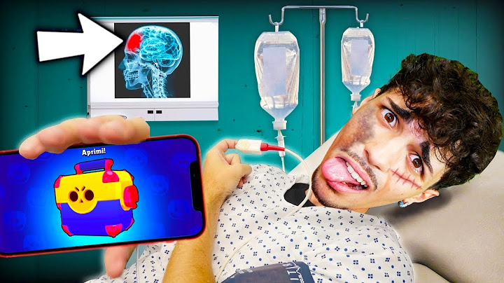MI SONO FATTO MALE E NON POSSO PIÙ GIOCARE A BRAWL STARS?!💀