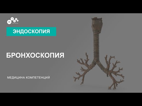 Бронхоскопия // Подготовка перед бронхоскопией // Когда назначают бронхоскопию