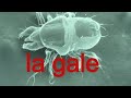 Parasitologie 3 les gales