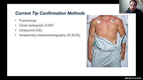 Webinar – The Evolution of ECG with Centrally Inserted Central Catheters (CICCs)