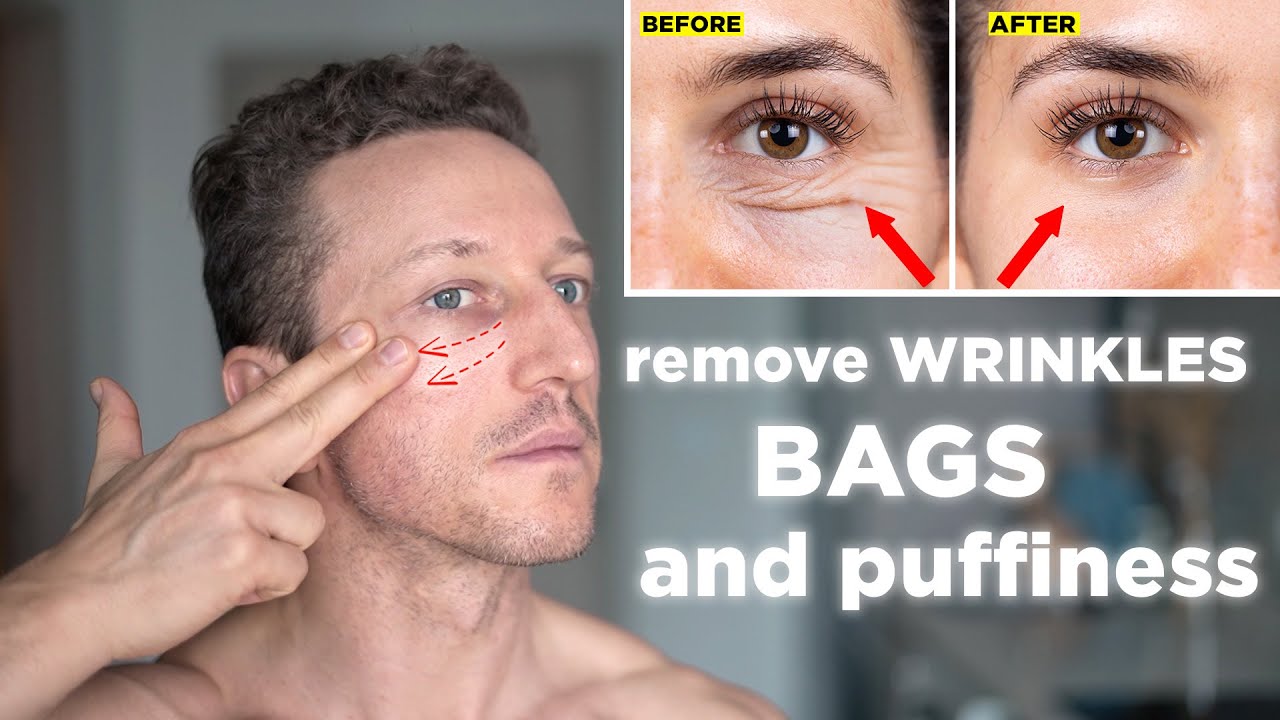 How To Remove Under Eye Bags And Wrinkles, 1-Minute Eye Massage - YouTube