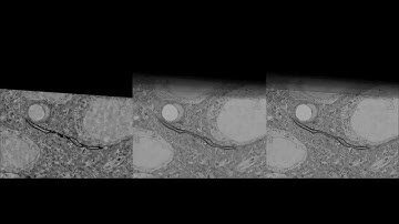 Gradient-Domain Processing for Large EM Image Stacks