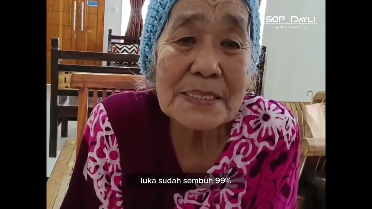 Thumbnail pengalaman pemulihan luka infeksi akibat paku
