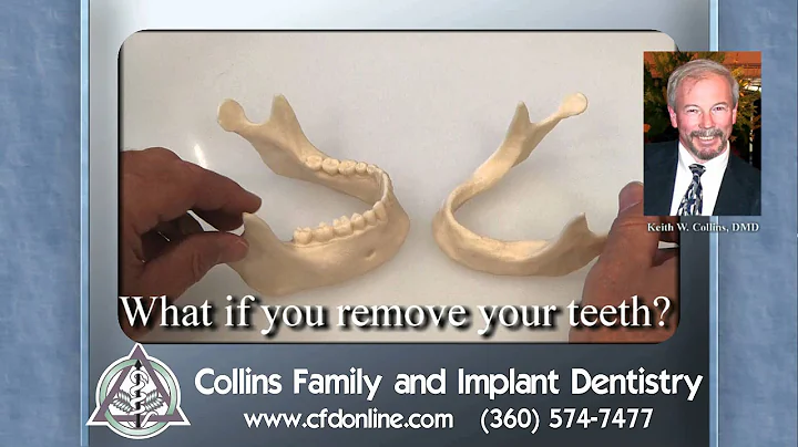 What happens if you remove all of your teeth?  By ...