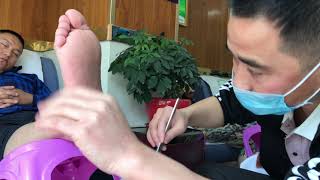 How to remove callus and dead skin |Perfect Foot Spa