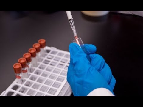 ეპიდსიტუაცია საქართველოში