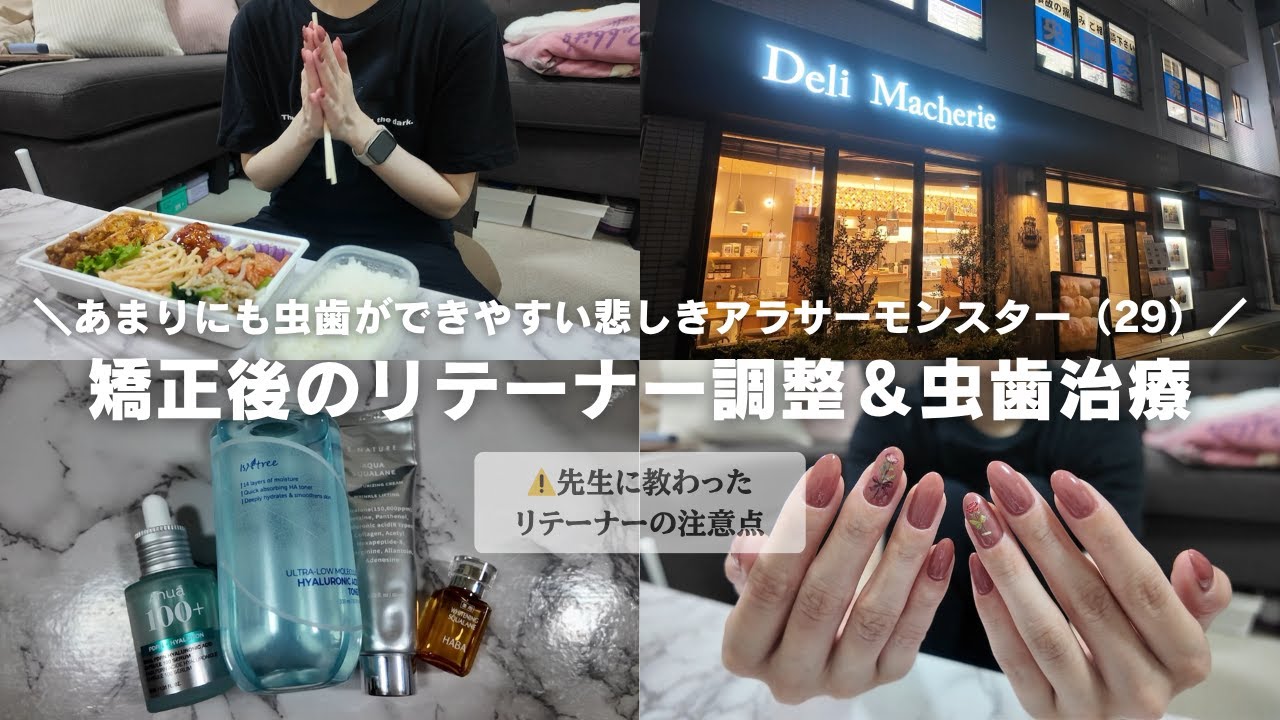 【ワイヤー矯正ブラオフ後】矯正期間の虫歯治療とリテーナー生活の不便さ