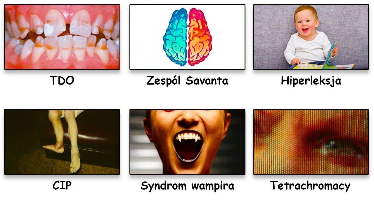 Prawdziwe Choroby Które Dają 