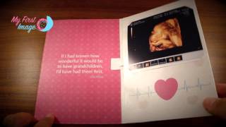 MY First Image - 3D 4D  Ultrasound Tucson - Baby's HeartBeat Sound Card