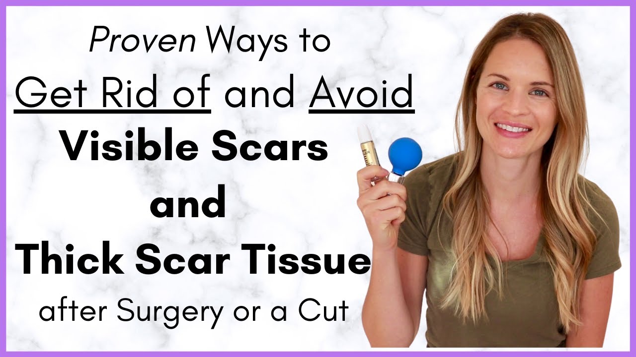 Proven Ways to Heal a Scar Quickly - Avoiding Scar Tissue after Surgery - By a Physical Therapist