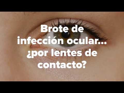 Brote de infección ocular por lentes de contacto