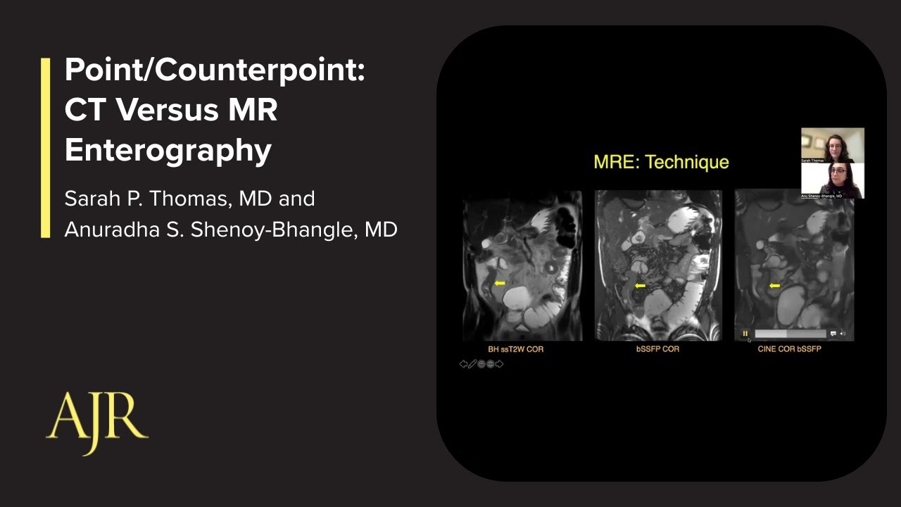 Point/Counterpoint: CT Versus MR Enterography
