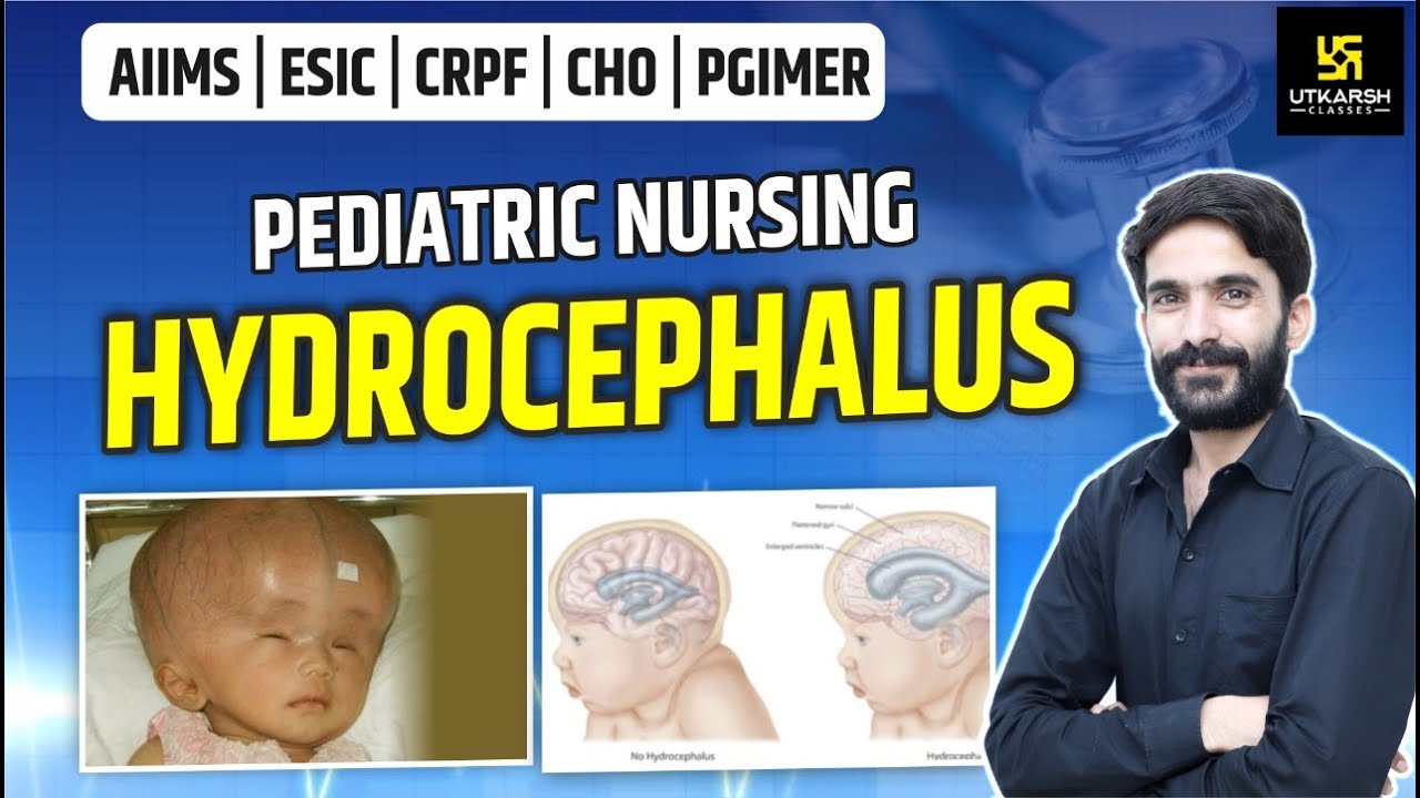 AIIMS | ESIC | CRPF | PGIMER | Hydrocephalus | Pediatric Nursing | By Raju Sir