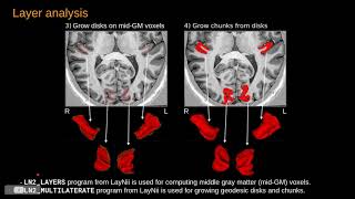 ISMRM 2021 Talk (0096) at 1080p