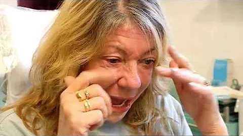 Jackie's amazing dentistry results - 10 Years Younger