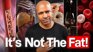 The High Triglyceride Myth Your Doctor Never Explained